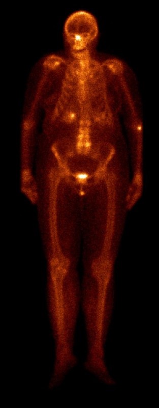 Anterior anterior